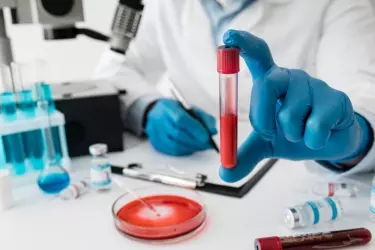 best pathology lab in Forbesganj, best lab for blood test in Forbesganj, best nabl lab in Forbesganj