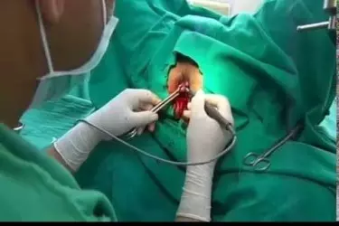 best hospital for piles surgery in Forbesganj, best doctor for piles fissure treatment in Forbesganj, cost of piles fissure surgery in Forbesganj